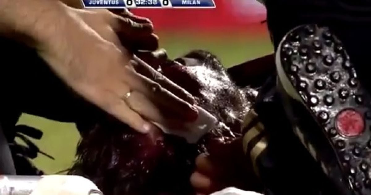 Лоб Антоніні залила кров