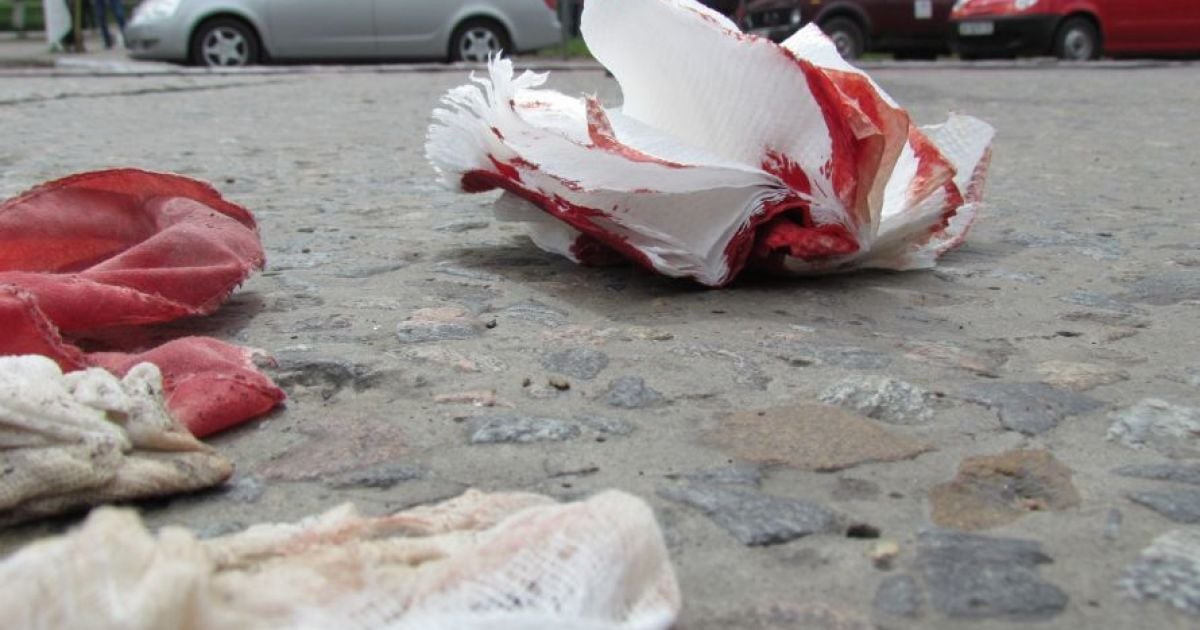 У Запоріжжі лихач збив дитину