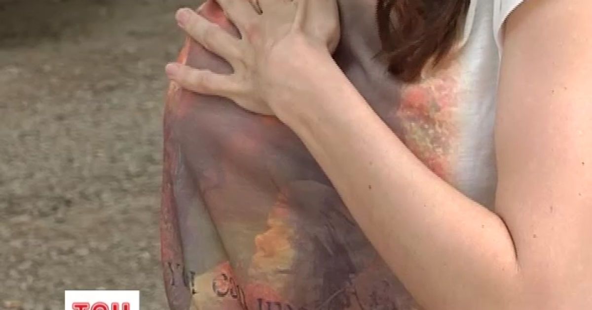 Через недобросовісних хірургів жінка втратила сон та спокій