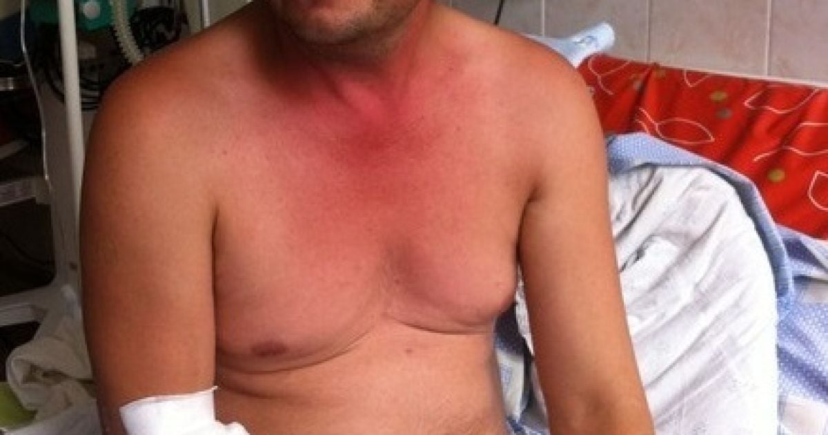 Жертва аварії на "Стиролі" розповів подробиці