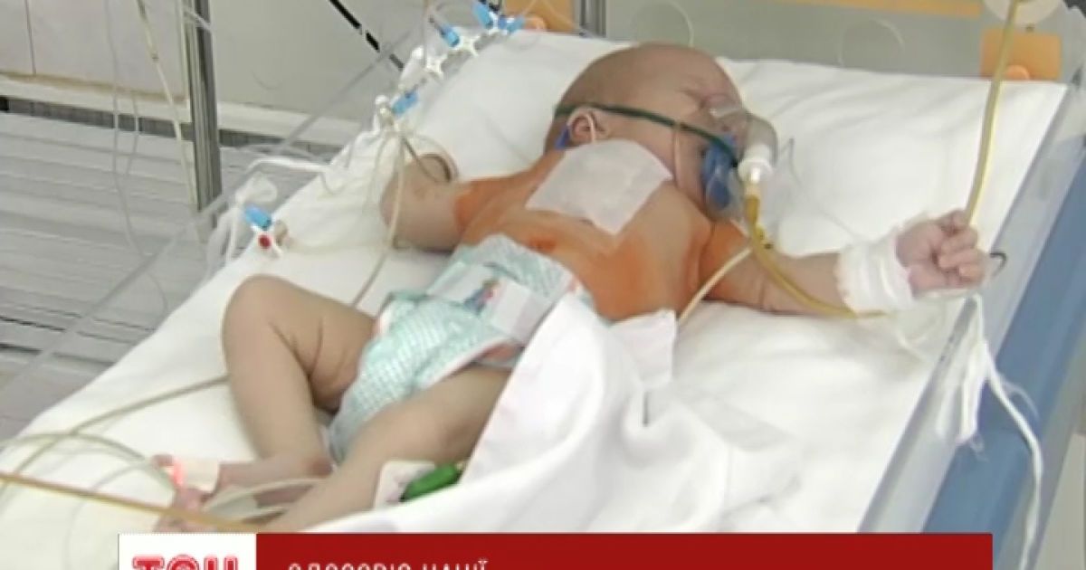 Українські лікарі рятують життя хворим немовлятам