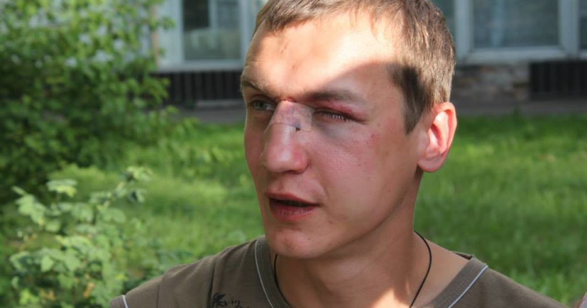 У Києві активіста побили за українську мову.
