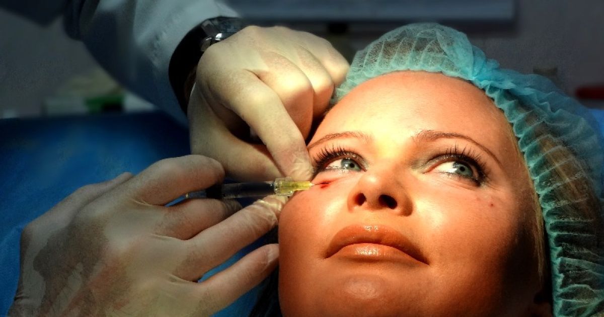 Борисова зробила пластику обличчя