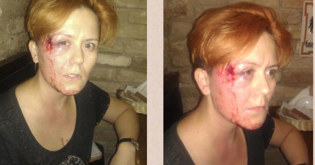 Ганну Гуцол сильно побили