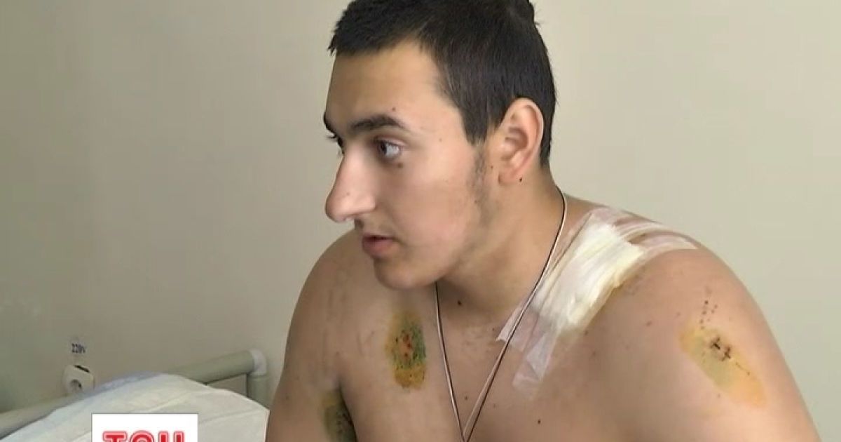 Юнак вижив після страшної різанини