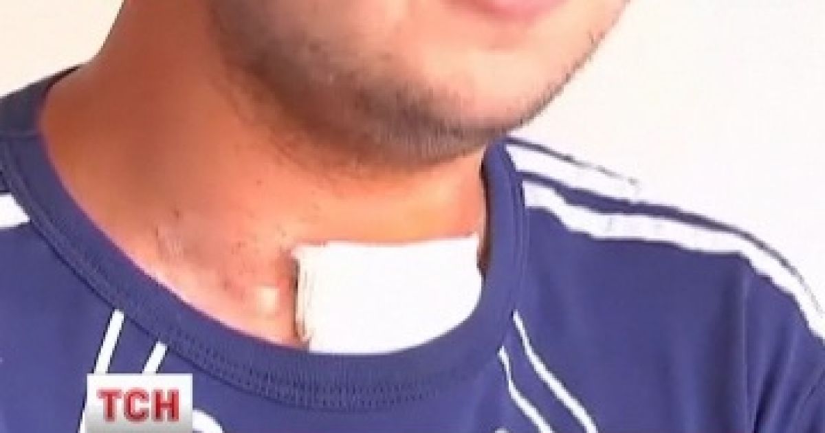 Водій авто розстріляв випадкового перехожого