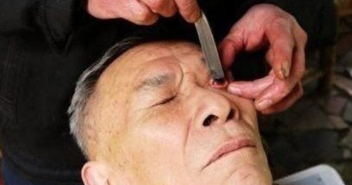 В Китаї люди ходять до майстра голити очі. / © cd.qq.com