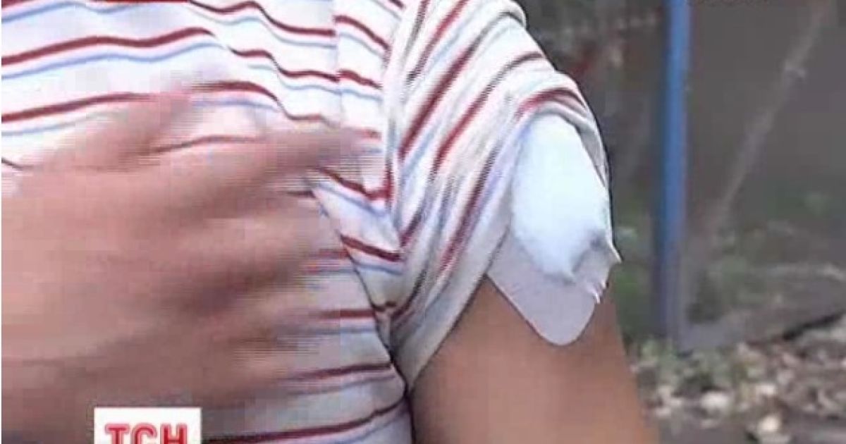 В Одесі почали використовувати кулі як аргументи