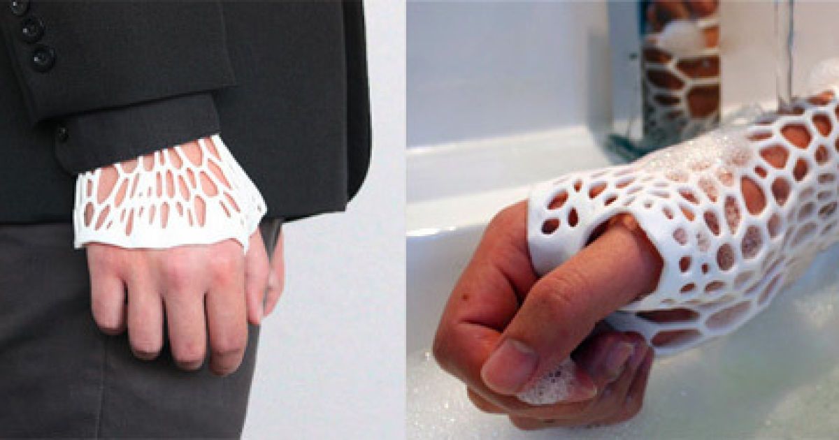 Новозеландець надрукував на 3D-принтері гіпс