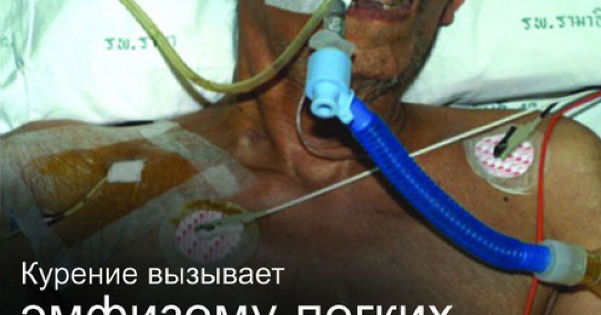 На пачках сигарет з'являться попередження для курців / © Московский комсомолец