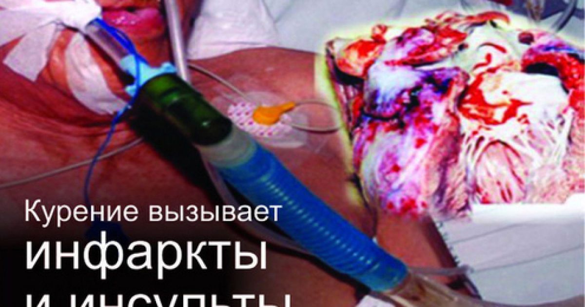 На пачках сигарет з'являться попередження для курців / © Московский комсомолец