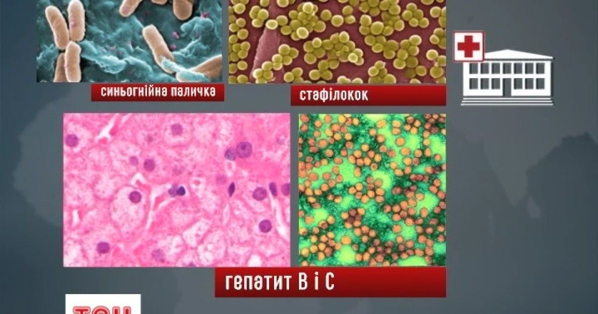 Кожний четвертий пацієнт може підчепити смертельну інфекцію та гепатит