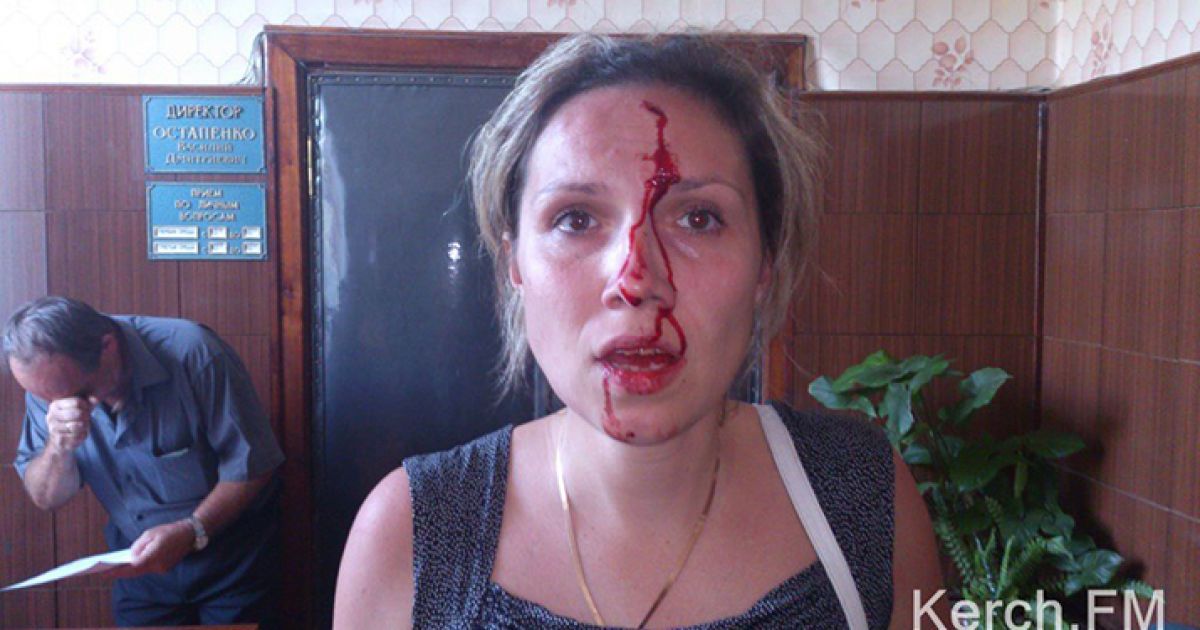 Дівчина поскаржилася на побиття після прийому в депутата