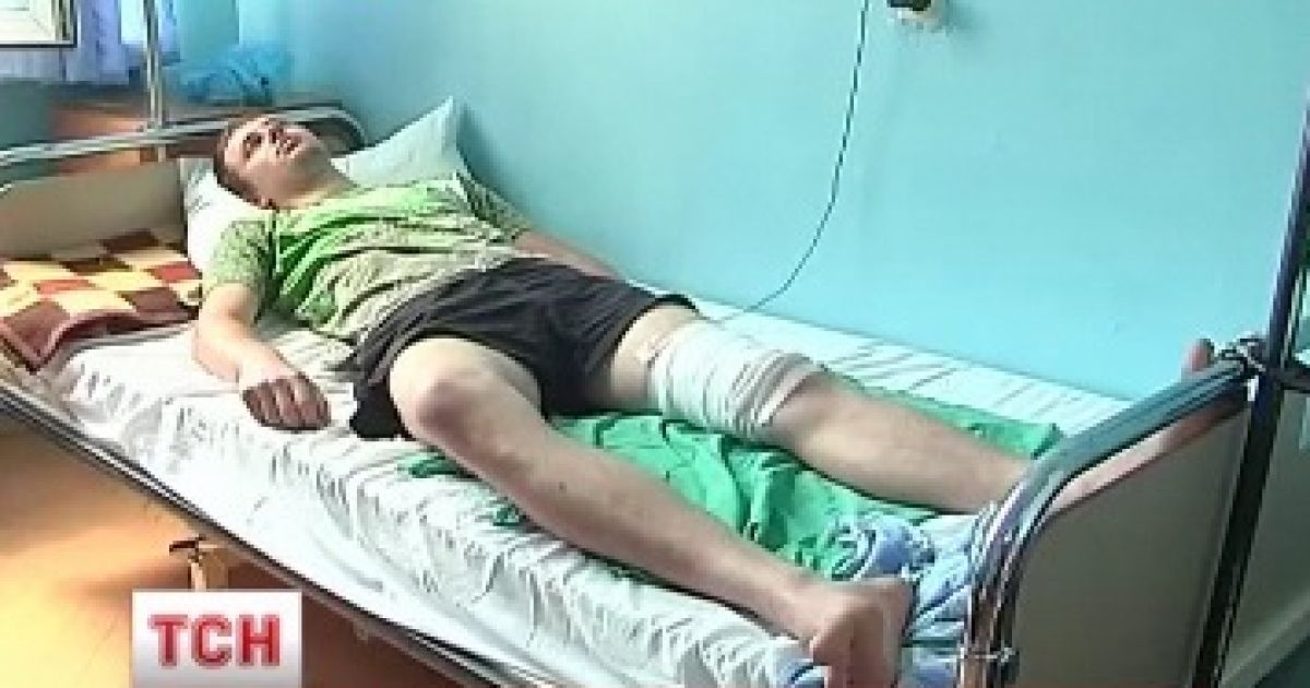 Ревнивець прострелив студенту ногу через колишню дівчину