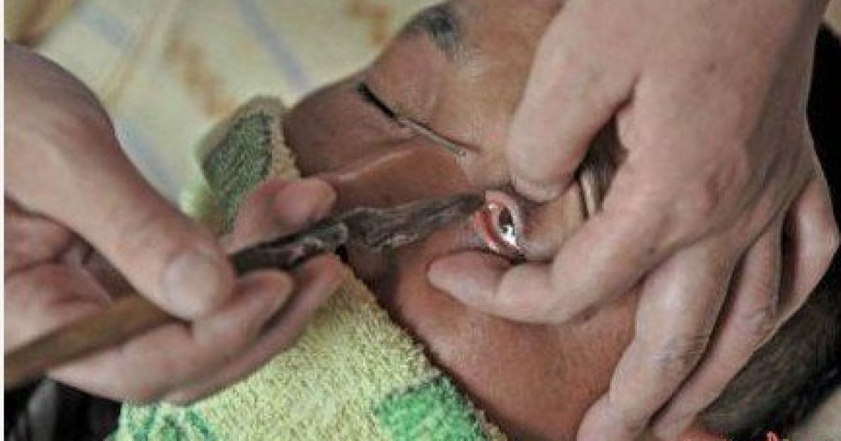 В Китаї люди ходять до майстра голити очі. / © cd.qq.com