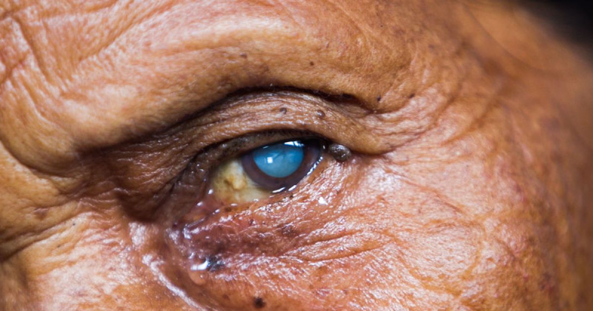 Вчені навчилися вирощувати клітини сітківки.