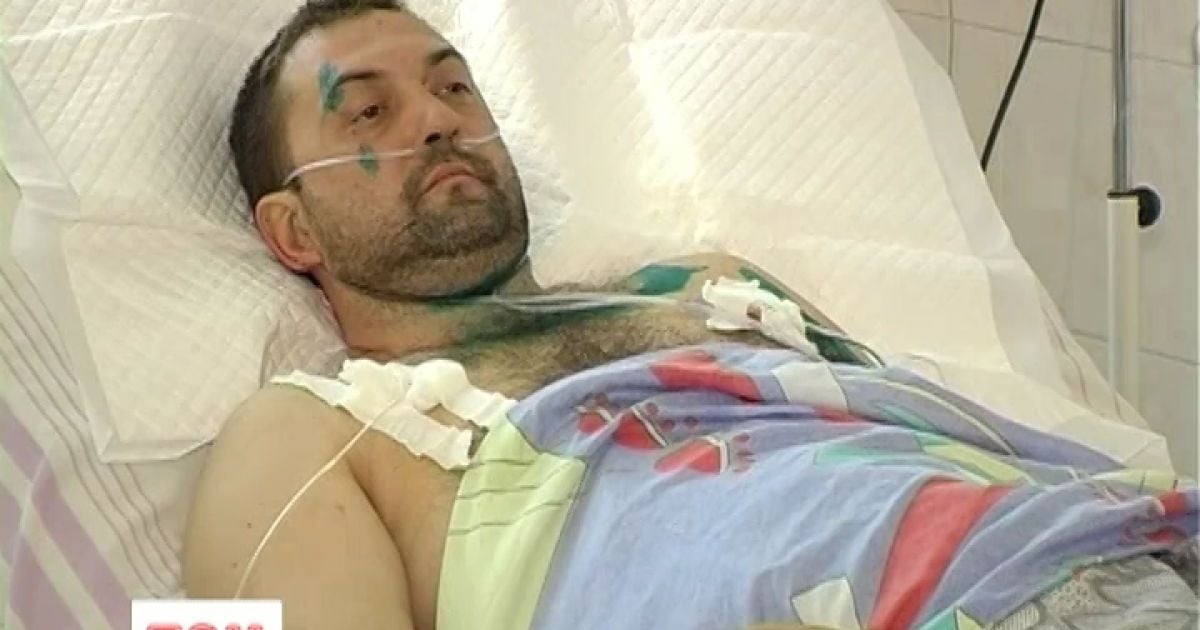 Чоловіку, який вижив у вогні, не кажуть, що його родичі загинули