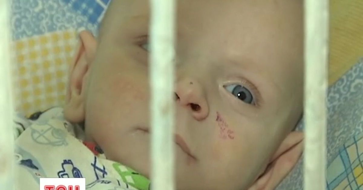 Дитина голодувала так довго, що забула як їсти.