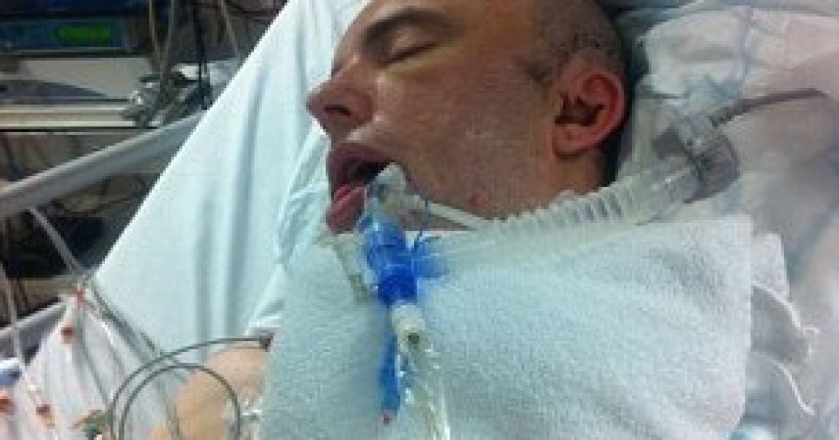 Майк Еванс втратив половину черепа після сутички з польським боксером.