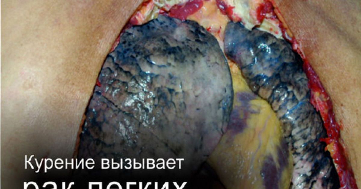 На пачках сигарет з'являться попередження для курців / © Московский комсомолец