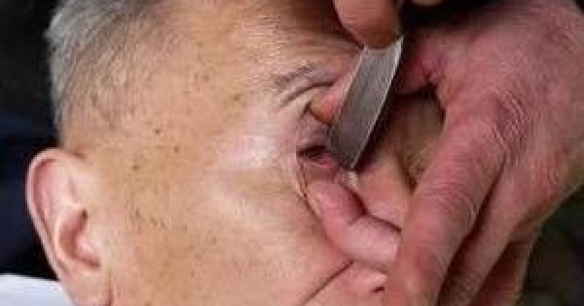 В Китаї люди ходять до майстра голити очі. / © cd.qq.com