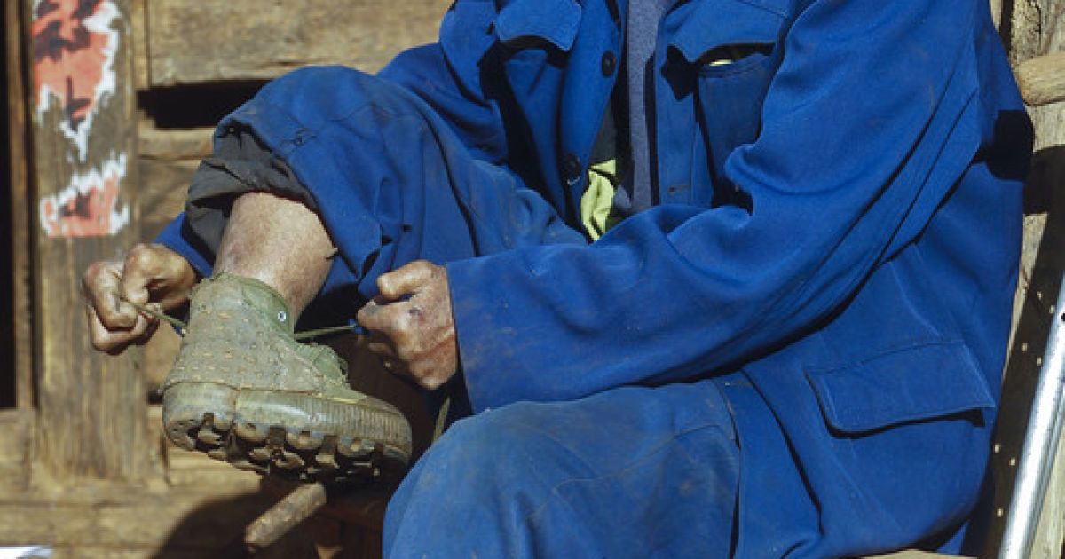 У Китаї досі працюють резервації для хворих на проказу / © Фото EPA/UPG