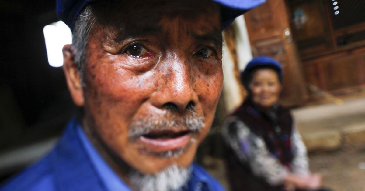 У Китаї досі працюють резервації для хворих на проказу / © Фото EPA/UPG