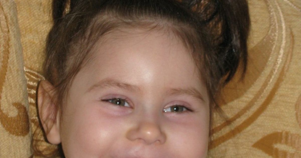 В помощи нуждается 4-летняя Валерия!