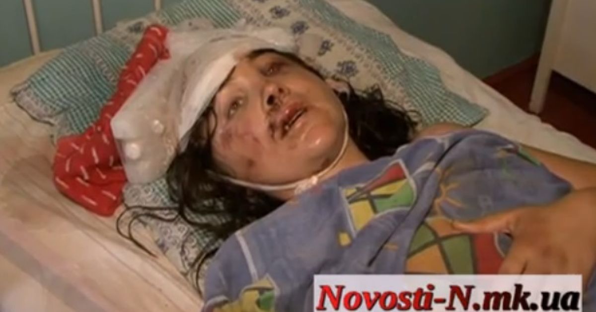 Жителі Врадіївки збирають гроші для лікування жінки