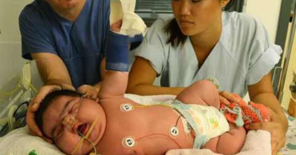 Дівчинка народилася вагою в 6,15 кг.