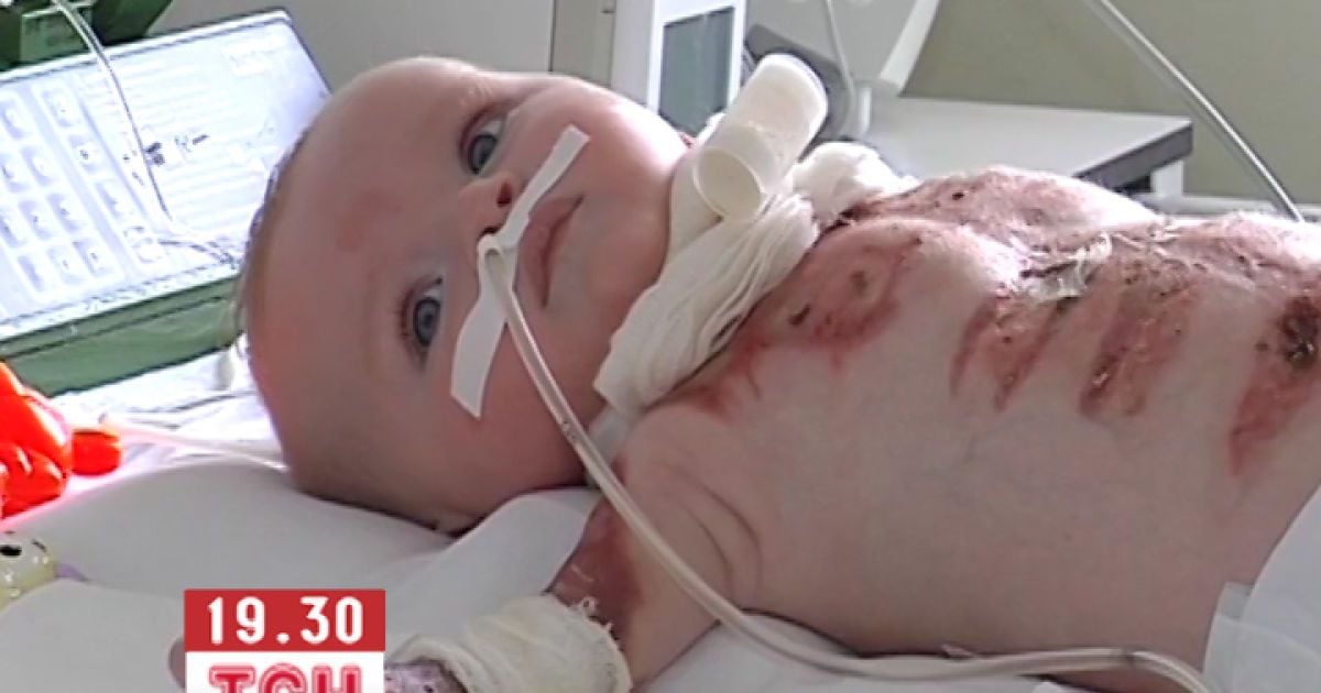 Батьки уже витратили на лікування усі свої заощадження, тож тепер допомоги просять в усіх небайдужих