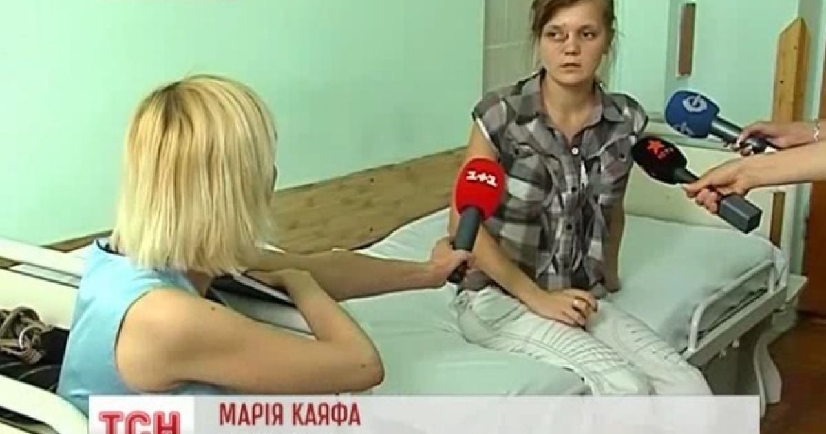 Дівчина постраждала від розпеченої смоли