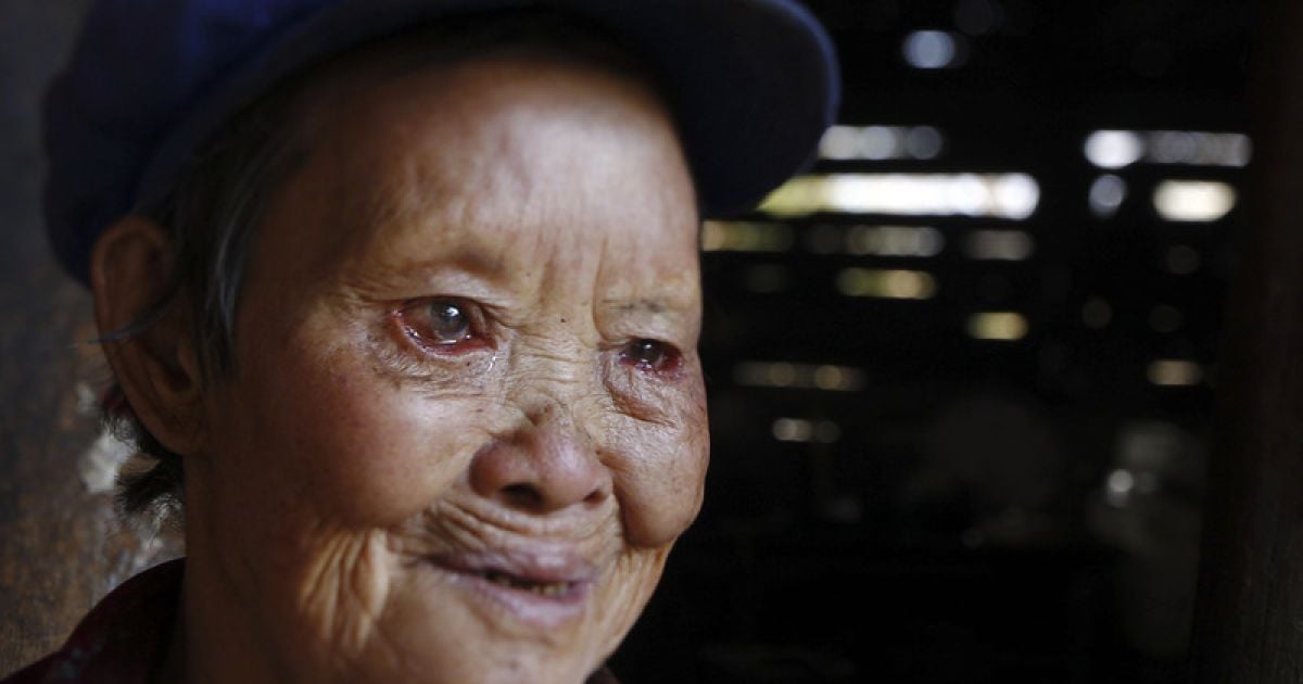 У Китаї досі працюють резервації для хворих на проказу / © Фото EPA/UPG