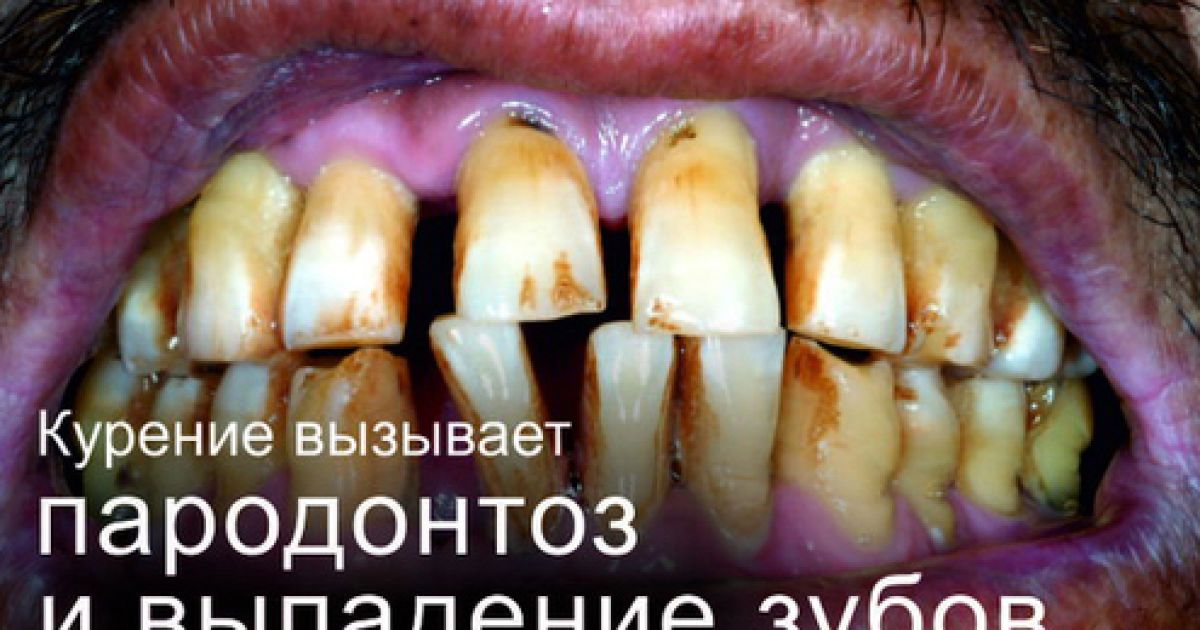На пачках сигарет з'являться попередження для курців / © Московский комсомолец