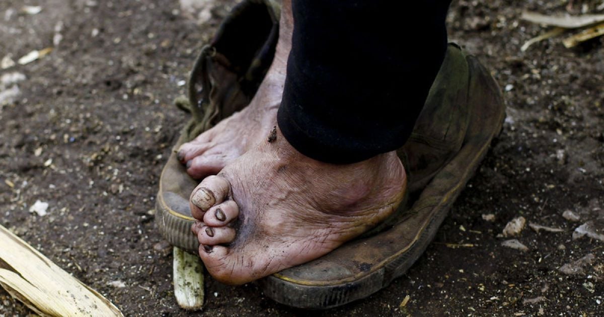 У Китаї досі працюють резервації для хворих на проказу / © Фото EPA/UPG