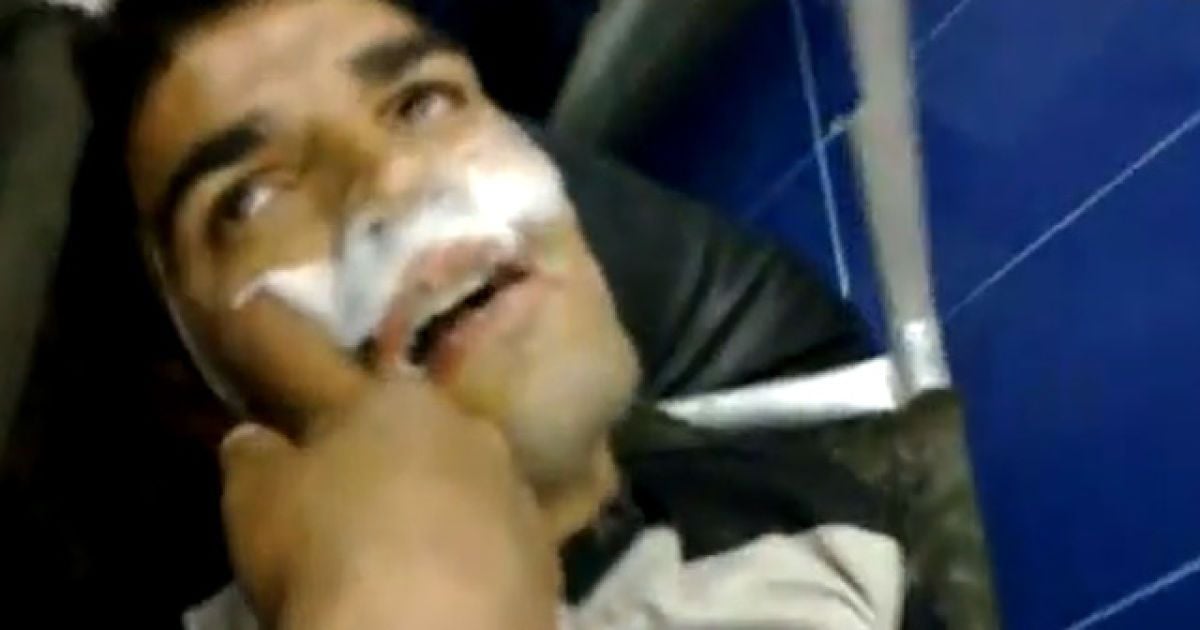 Аналізи зразків, проведені в одній з французьких лабораторій, свідчать про наявність в них зарину