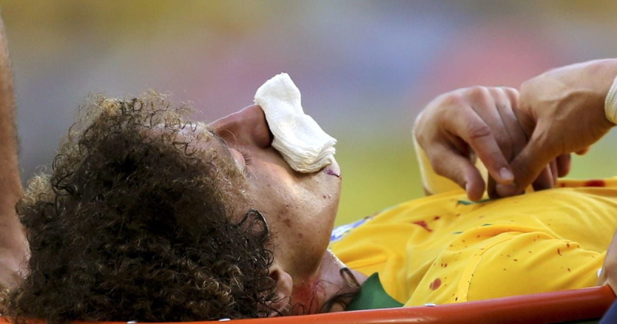 Луїс зламав ніс у матчі з Мексикою