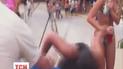 У девушки после участия в конкурсе по быстрому питью произошел спазм сосудов головного мозга