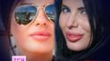 Пластичний хірург відкриває подробиці пластики губ відомих зірок