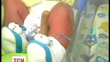 В Колумбии родилась чрезвычайно большой ребенок