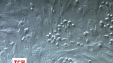 Ученые научились определять психическое заболевание благодаря анализам взятым из носа