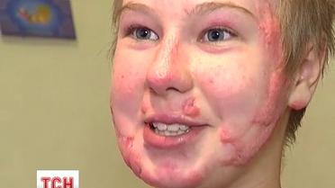 Девочка чудом выжила после взрыва газа в своей квартире