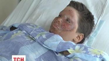 Мальчик чудом остался жив после разряда в 27 тысяч вольт