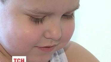 Умерла 2-летняя Аня, которая получила 95% ожогов тела