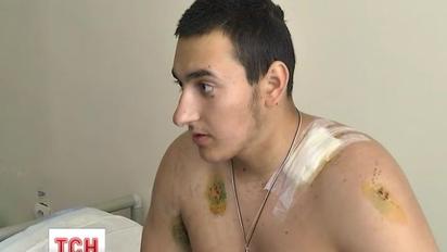 За відмову віддати гроші юнак отримав 27 ударів ножем