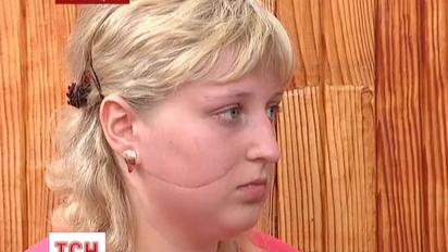 Жертва борзнянського різника може більше ніколи не завагітніти