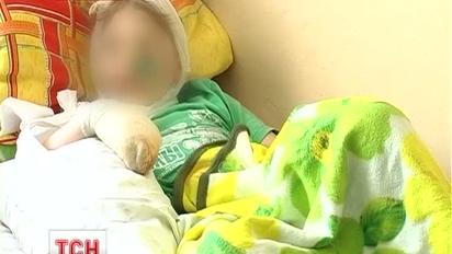 9-річному хлопчику відірвало 3 пальці
