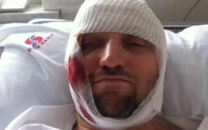 В Одесі жорстоко побили головного анархіста України