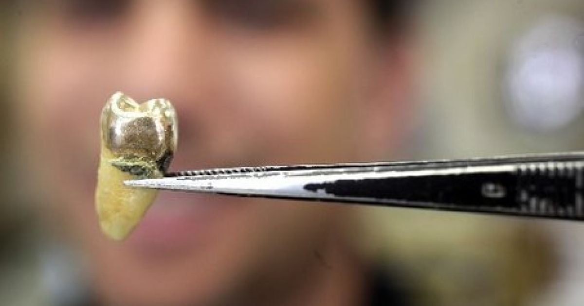 Чиновницю пограбували на зуби