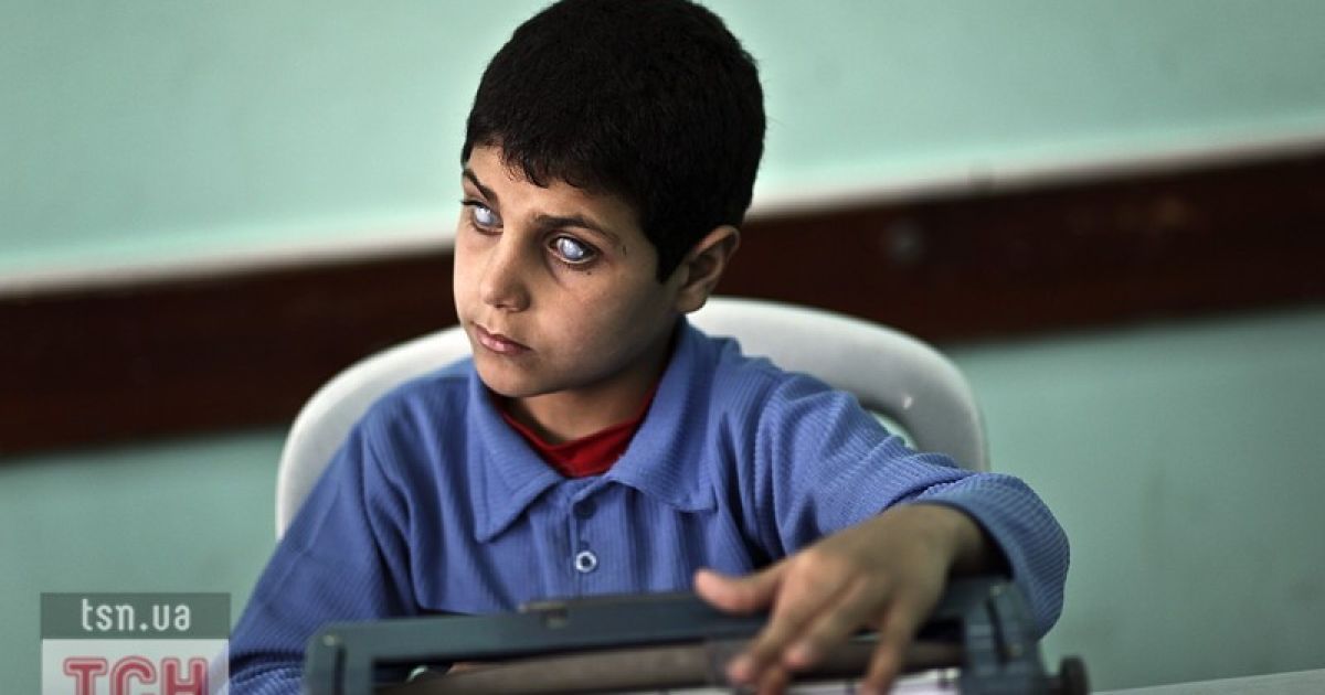 Сліпий хлопчик із сектору Газа / © Фото EPA/UPG